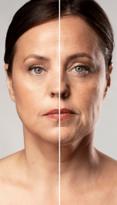 anti aging