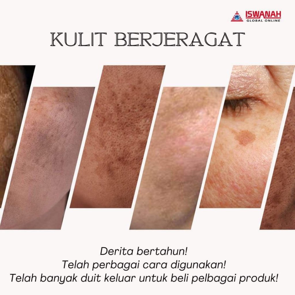 rawatan jeragat